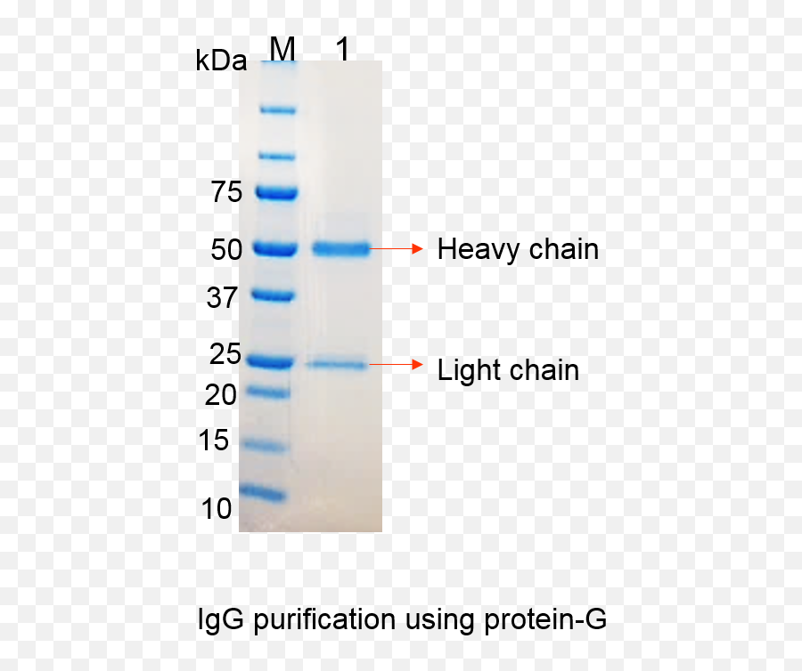Download Hd Igg Monoclonal Antibody Gel Transparent Png Emoji,Antibody Png