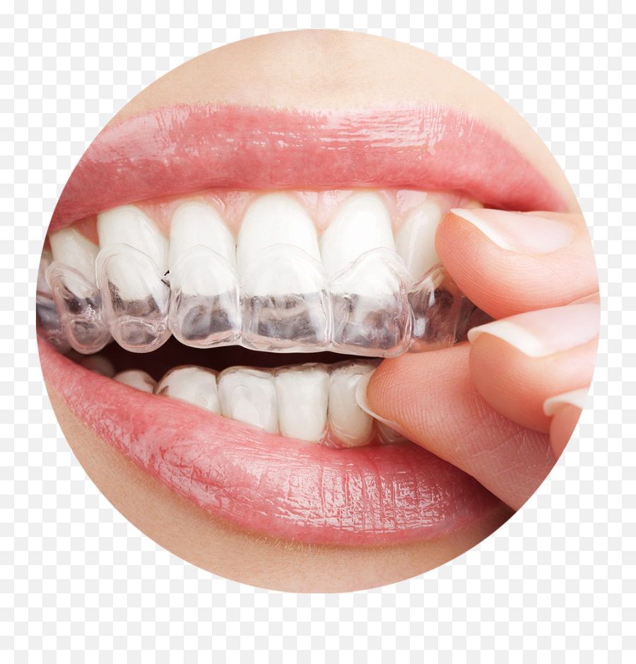 Clearcorrect Braces Dental Clinic - Teeth Whitening Gel Emoji,Braces Clipart