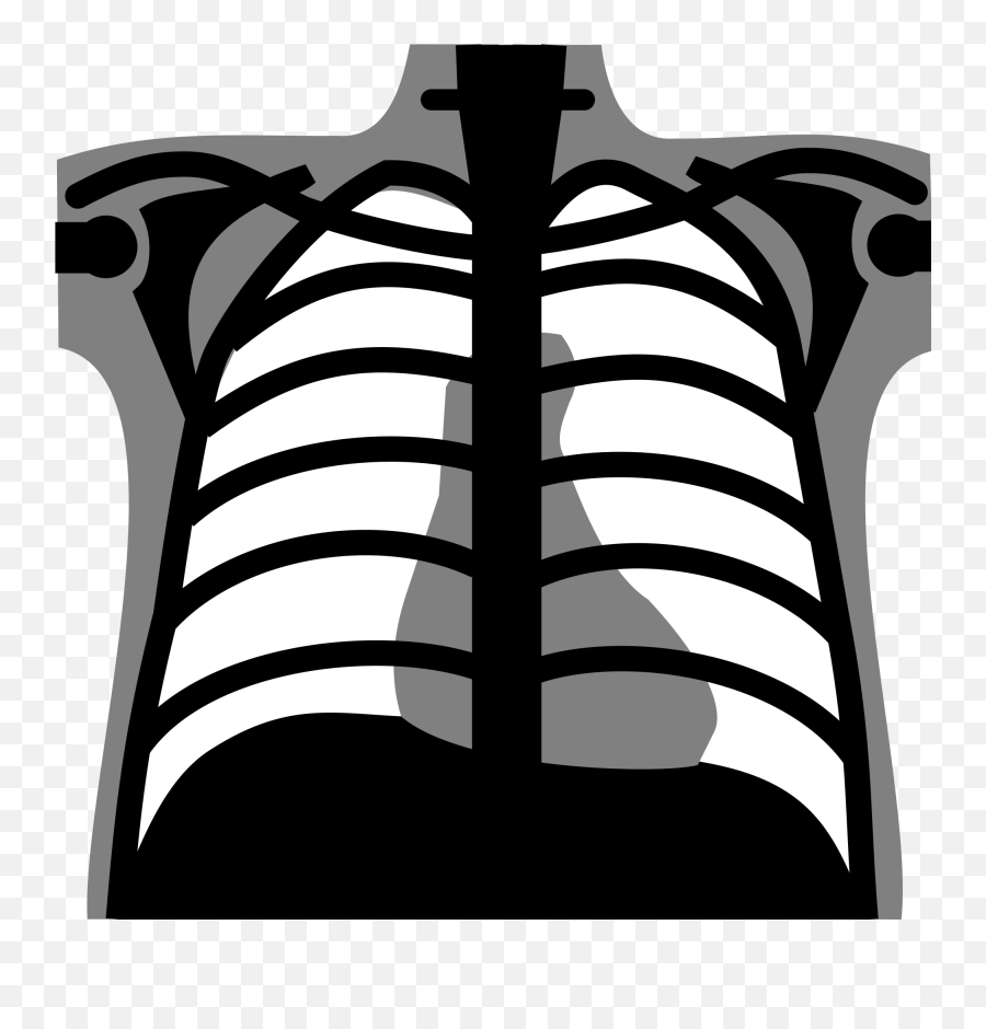 X Ray Png Clipart - Thorax X Ray Icon Emoji,X Clipart