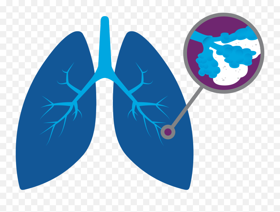 Genentech Understanding Idiopathic Pulmonary Fibrosis Emoji,Diagnosis Clipart
