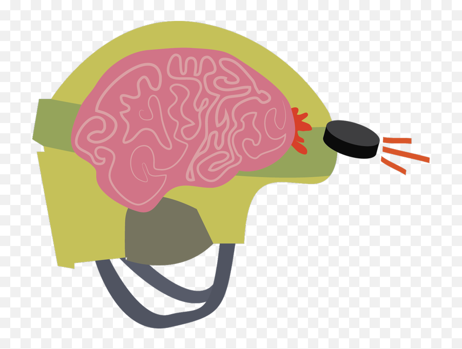 Study Concussion Damage May Linger After Symptoms Disappear Emoji,Mri Clipart