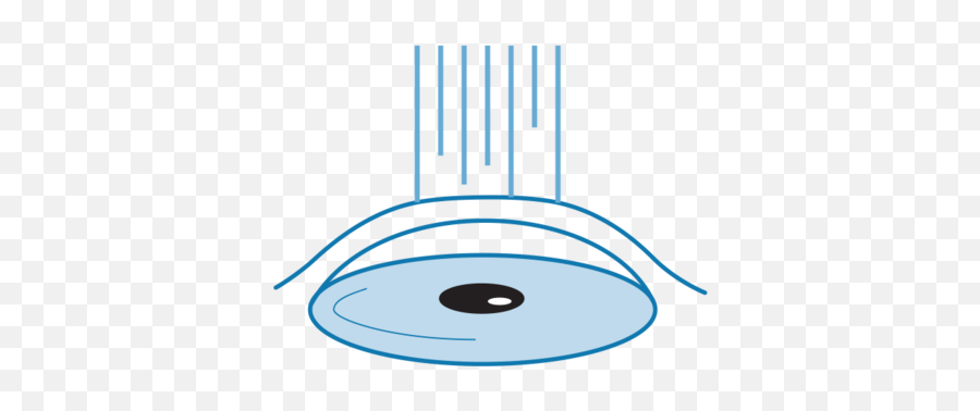 Photo Refractive Keratectomy Prk Or Asa U2014 Qei Laser Emoji,Laser Eye Png