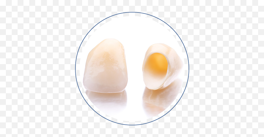 Porcelain Dental Crowns - David Eskow Dds Emoji,Broken Egg Png