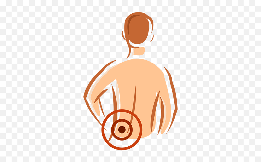Low Back Pain U0026 Sciatica Bliss Acupuncture Clinic - Sciatica Clipart Emoji,Pain Clipart