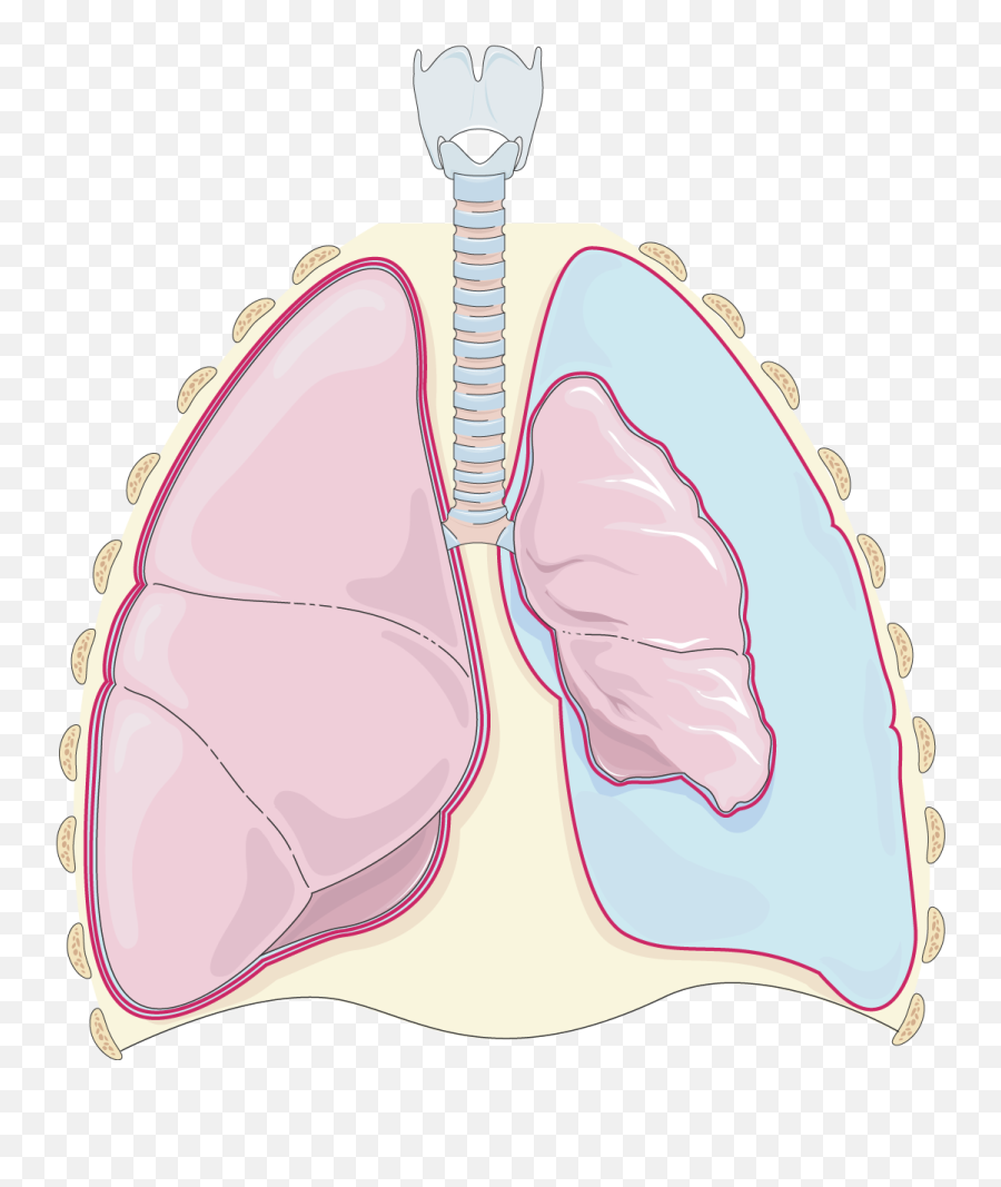 Lung Cancer - Servier Medical Art Illustration Png Clipart Illustration Pneumothorax Clipart Emoji,Lung Clipart