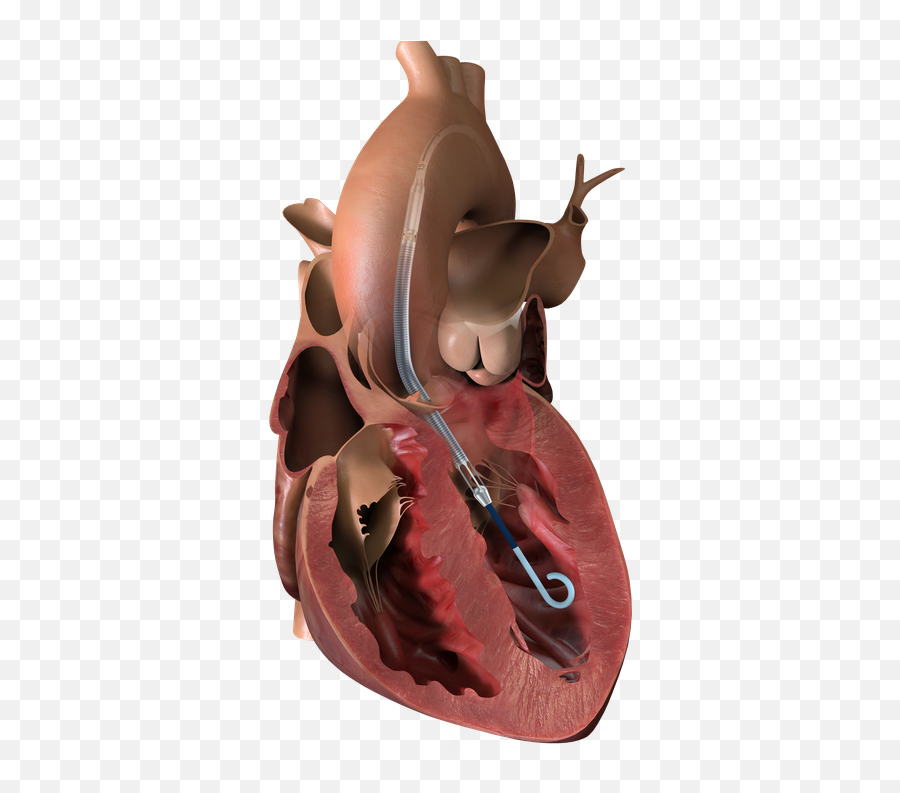 There Could Be Real Harm Thatu0027s Going On With This Device - Impella Emoji,Real Heart Png