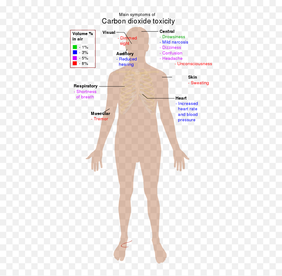Carbon Dioxide Toxicity - Sulfur Symptoms Of Toxicity Emoji,Headache Clipart