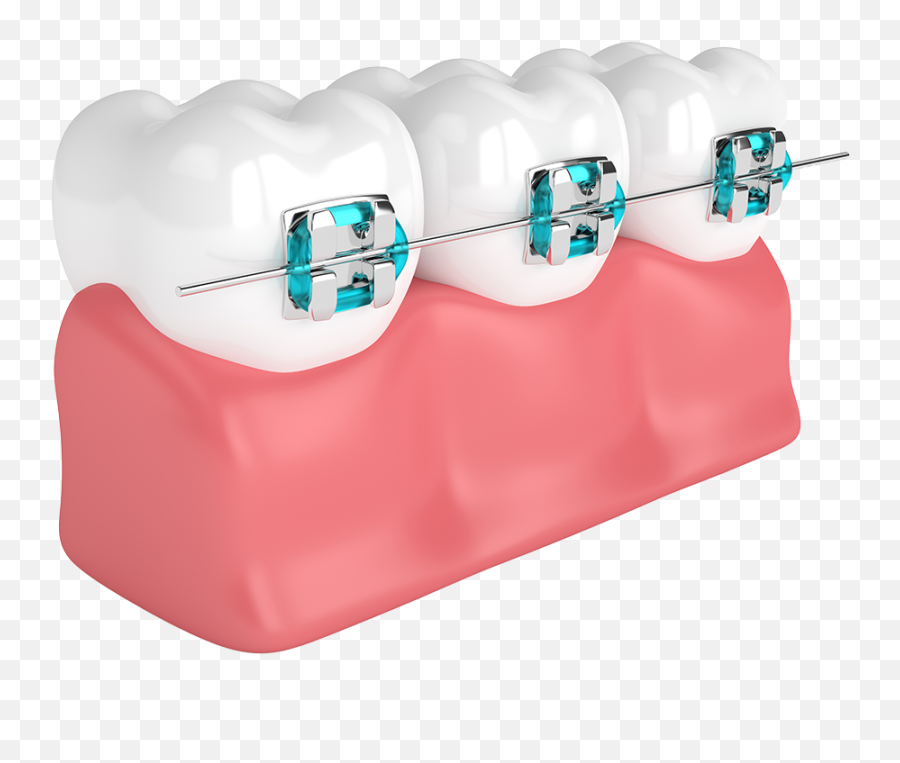 Dental Braces Transparent Cartoon - Tooth With Braces Png Emoji,Braces Clipart