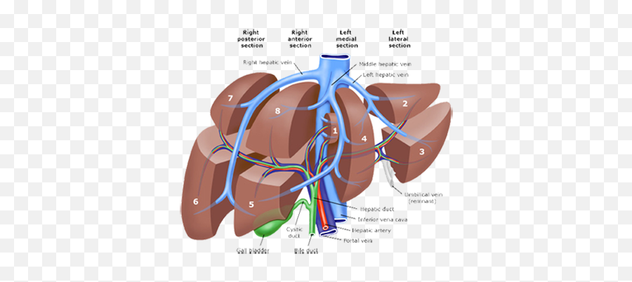 Download Pld Liver Resection Polycystic - Liver Anatomy Emoji,Liver Png