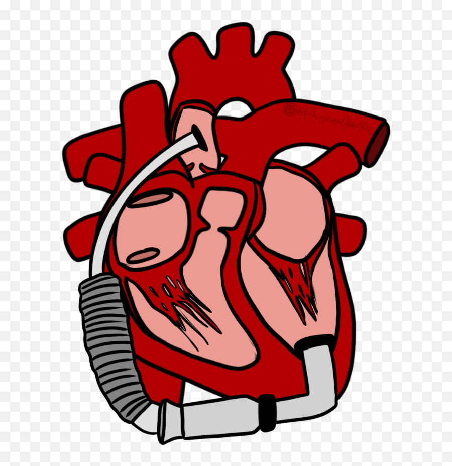 Criticalcarenow - Page 17 Of 83 A Site For Intensivists Emoji,Anatomical Heart Clipart