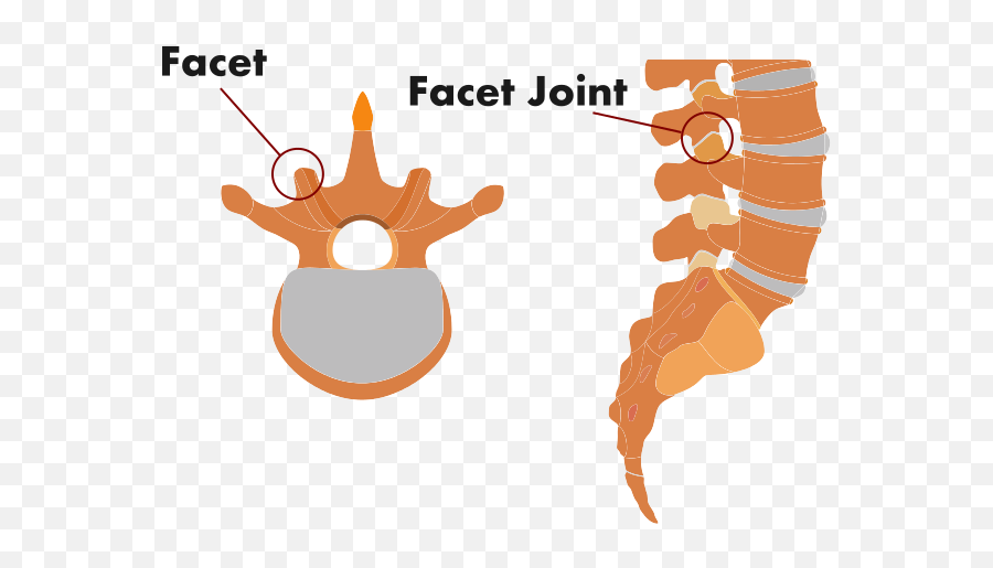 Download Facet Joint Spinal Injury - Language Emoji,Joint Png