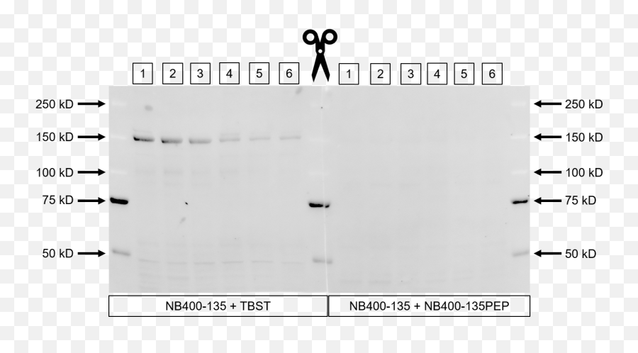 Chrebp Antibody Nb400 - 135 Novus Biologicals Emoji,Arden Cho Png