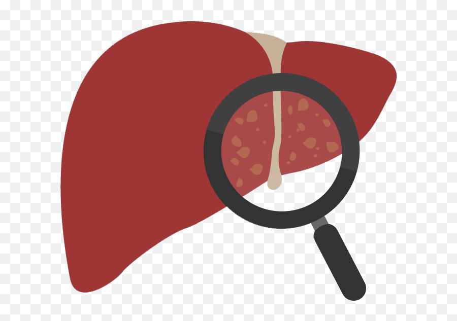 Gallstones In The Liver Clipart - Gallstones Clipart Png Emoji,Liver Clipart
