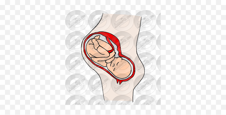 Pregnancy Picture For Classroom - Disease Emoji,Pregnancy Clipart