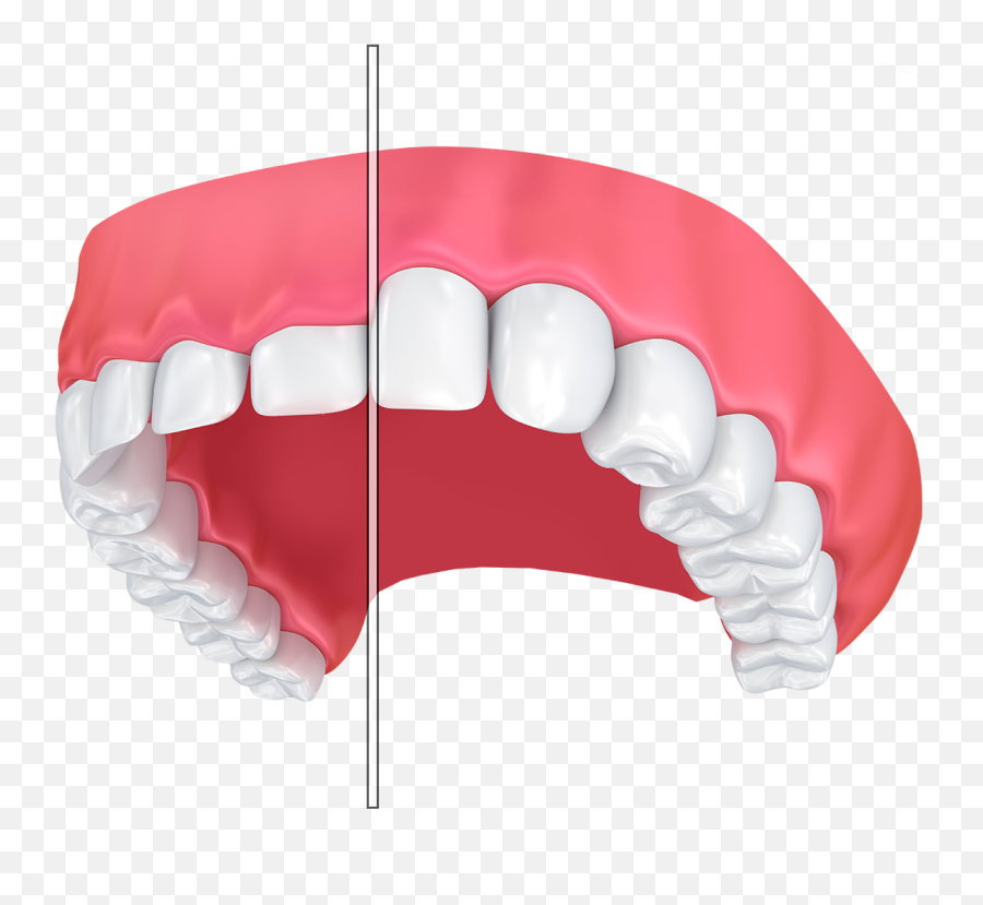 Gum Contouring For Small Teeth - Brooklyn Ny Dr Eugene Emoji,Brooklyn Bridge Clipart