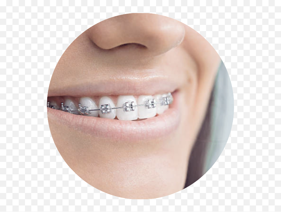 Dentist In Groton Dental Office In Groton Groton - Celebrities With Braces Emoji,Star Logos