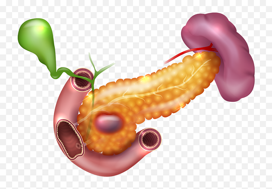 Darkspots In Pancreas - Uncinate Process Emoji,Liver Clipart