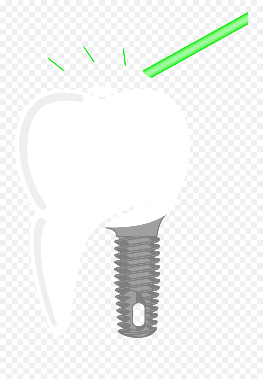 Wahpeton Nd Dentist Dentist In Wahpeton Nd Fargo Nd Emoji,Tooth Transparent Background