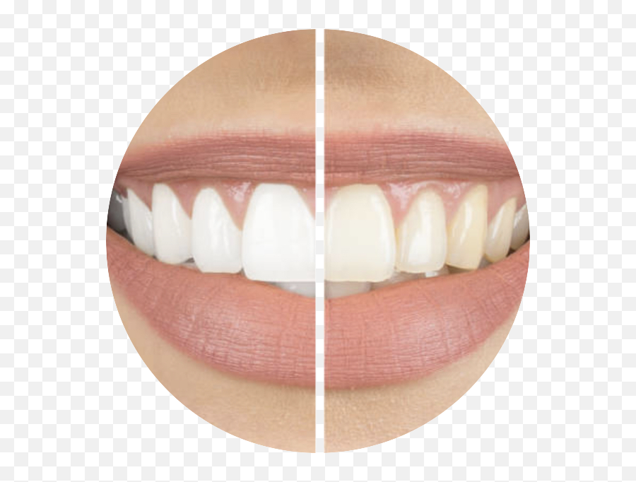 Dentist In Groton Dental Office In Groton Groton - Do Electric Toothbrushes Whiten Teeth Emoji,Star Logos