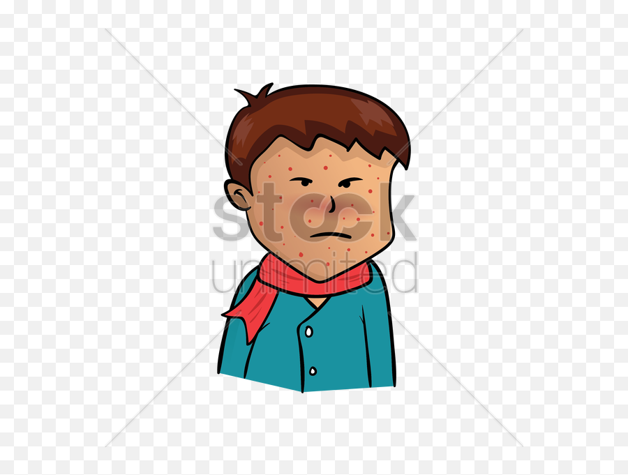 Pox Group Boy Having Chickenpox Vector Image - Unwell Emoji,Crying Boy Clipart