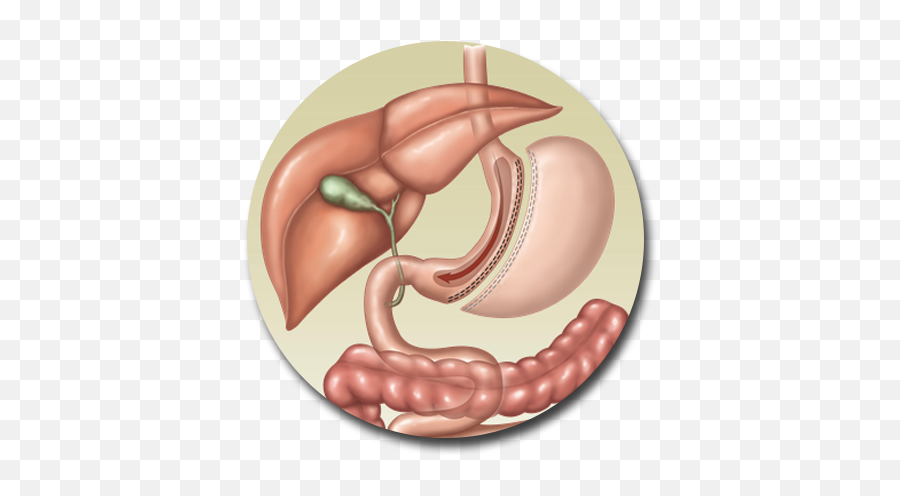 Sleeve Gastrectomy Procedure In Reno U2013 Western Bariatric Emoji,Liver Clipart