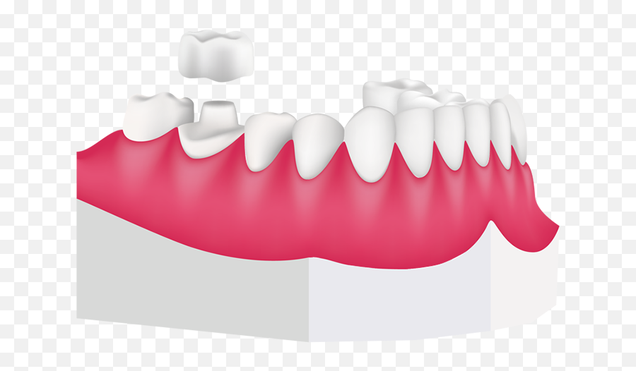 Library Of Tooth Banner Transparent Crown Png Files - Bracket Emoji,Dentist Clipart
