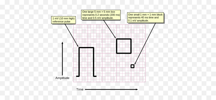 Fileecg Graph Paperpng - Wikidoc Emoji,Graph Paper Transparent