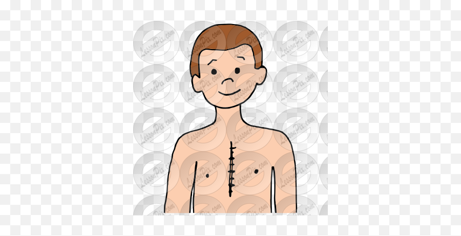 Scar Picture For Classroom Therapy Use - Great Scar Clipart Emoji,Scar Transparent