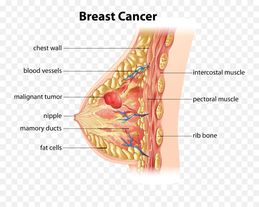 Breast Cancer Awareness - Breast Cancer Anatomy Emoji,Breast Cancer Clipart