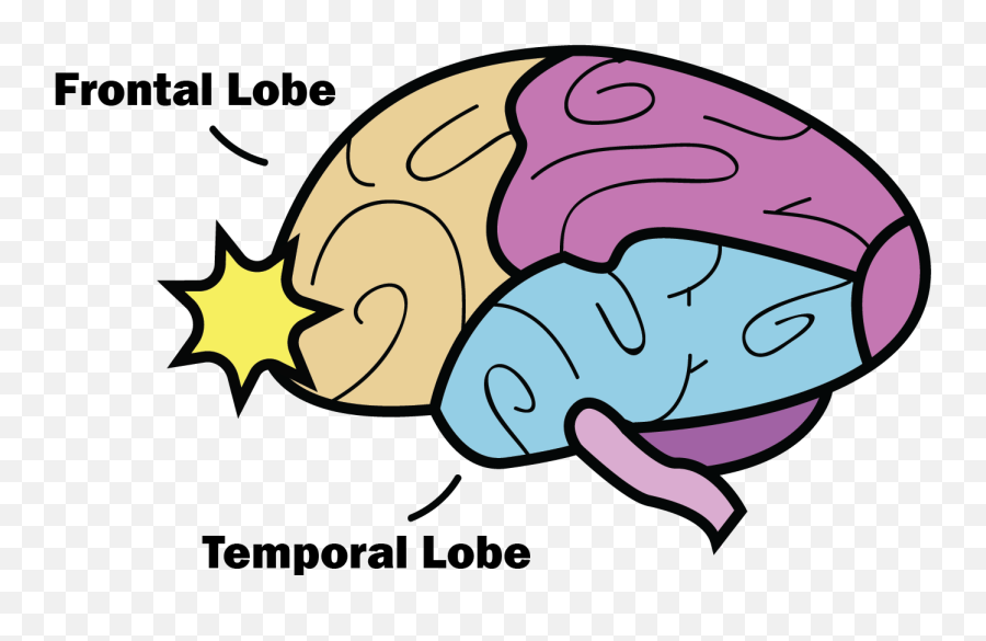 Clipart Brain Concussion - Frontal And Temporal Lobes Temporal Lobe Clip Art Emoji,Clipart Brain