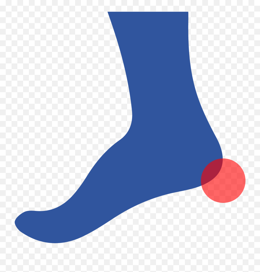A Heel Spur Is A Calcium Deposit That Forms A Small - Sock Vertical Emoji,Sock Clipart