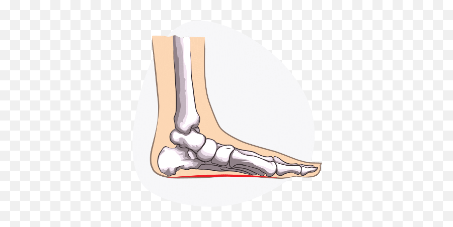 Fix Flat Feet - Building Arches With Exercise Emoji,Feet Transparent