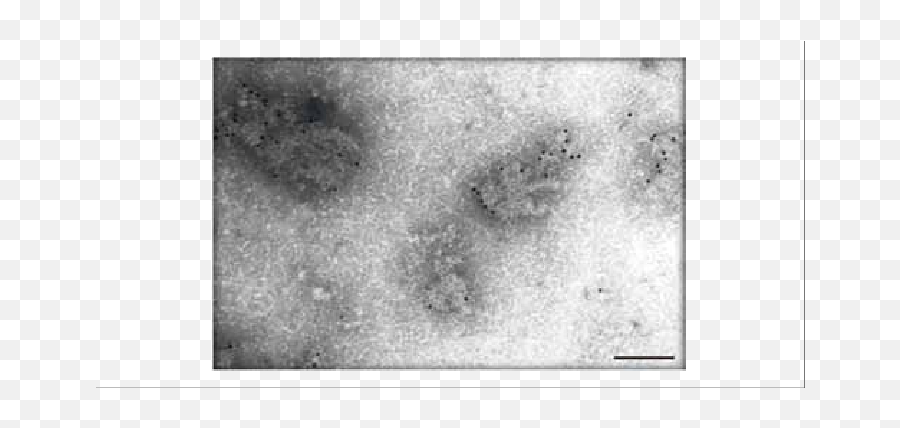 Double - Staining Iem Of Rabies Virus Preparations After Emoji,Gold Dots Png