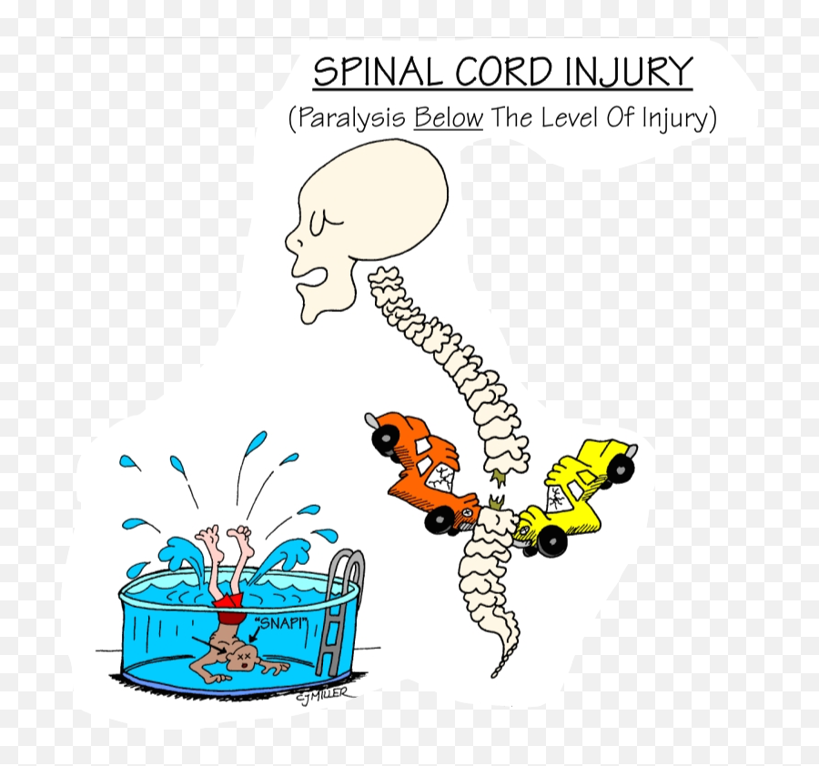56 Quadriplegia And Paraplegia Ideas Paraplegia - Spinal Cord Injury Nursing Education Consultants Emoji,Spine Clipart