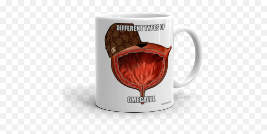 Different Types Of Omegalul - Magic Mug Emoji,Omegalul Png