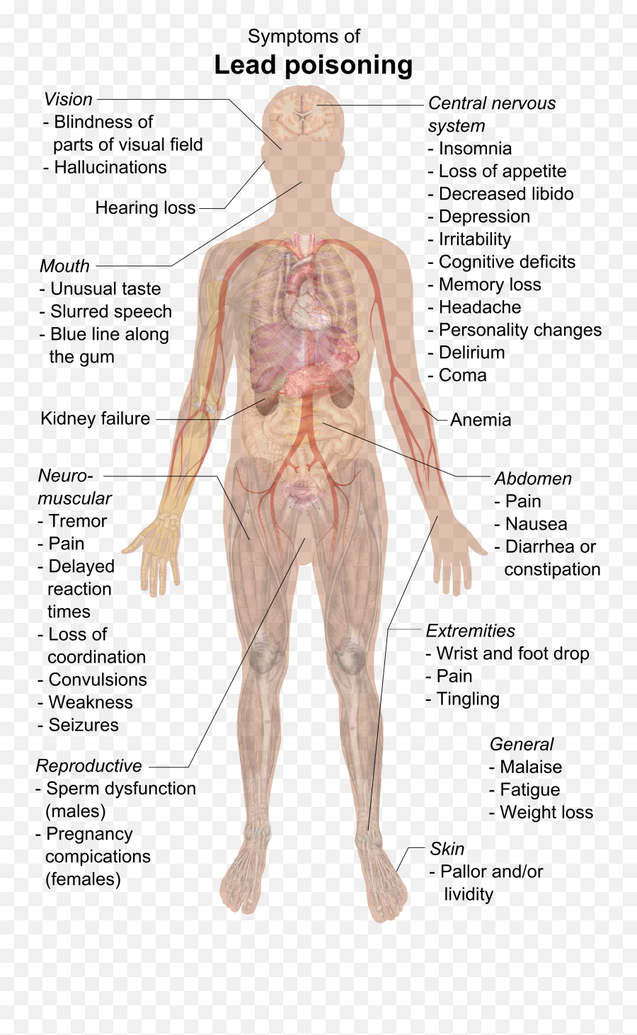 Filesymptoms Of Lead Poisoning Rasterpng - Wikimedia Commons Emoji,People Drinking Png