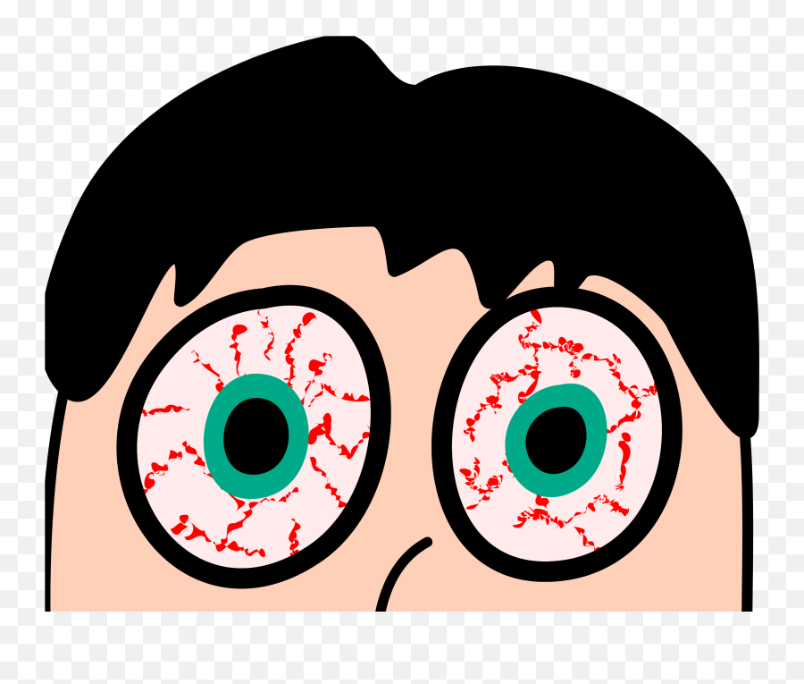 Dry Eye - Dry Eyes Png Emoji,Eye Clipart Png