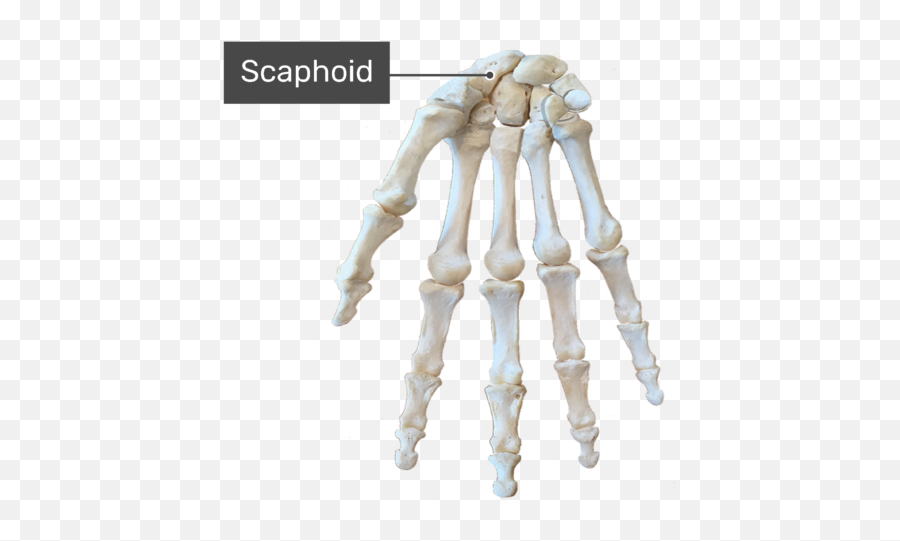 Hand And Wrist Bones - Anterior Palmar View Carpal Bones Png Emoji,Skeleton Hand Png