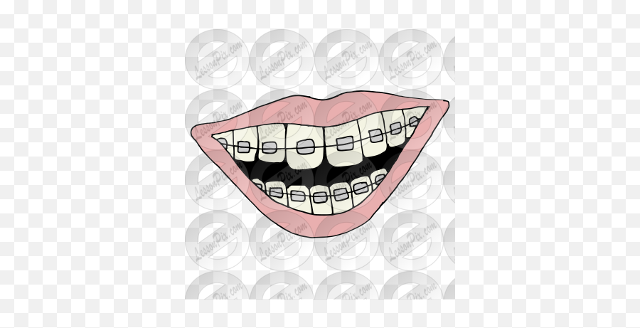 Braces Picture For Classroom Therapy - Happy Emoji,Braces Clipart