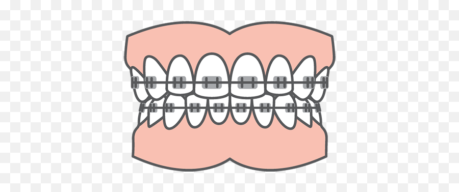 Orthodontics At Park Slope Dental Arts - Denture Icon Emoji,Braces Clipart
