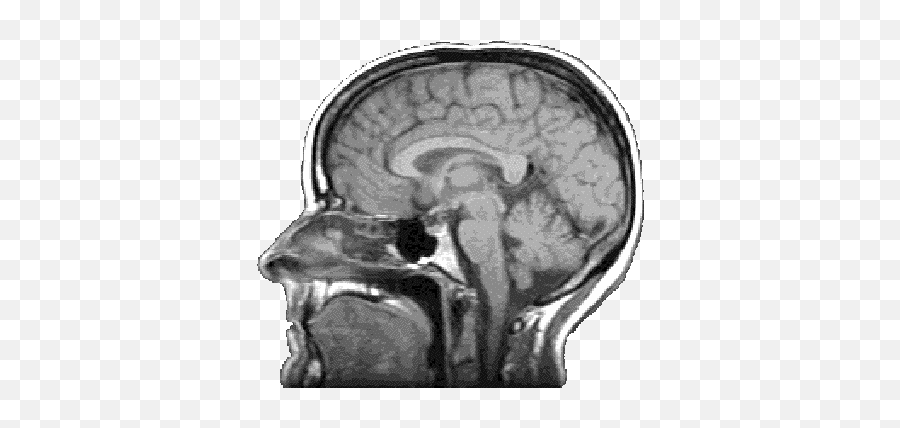 Brain Scan Transparent Background - Mri Brain Scan Png Emoji,Brain Transparent Background